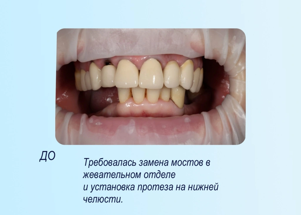 02.jpg